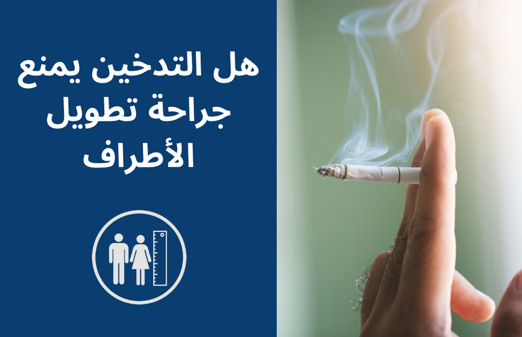 هل التدخين يمنع جراحة تطويل الأطراف